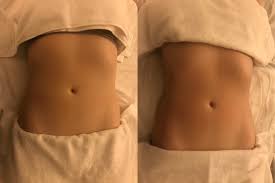 Lymphatic Massage Lymphatic Massage